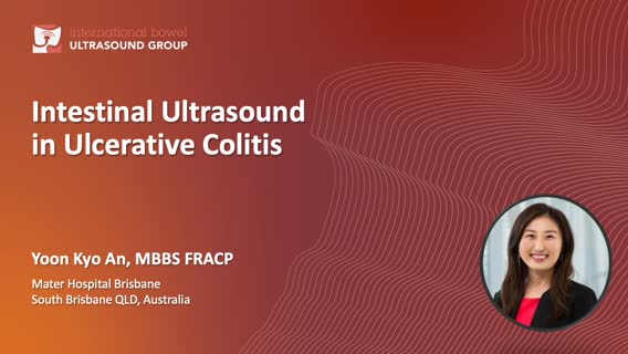 IUS in Ulcerative Colitis Yoon Kyo An (2021)